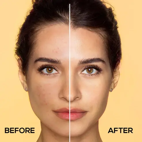 RENEE Vitamin C, Salicylic & Niacinamide Serum  view 5