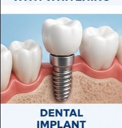 Dental Implants