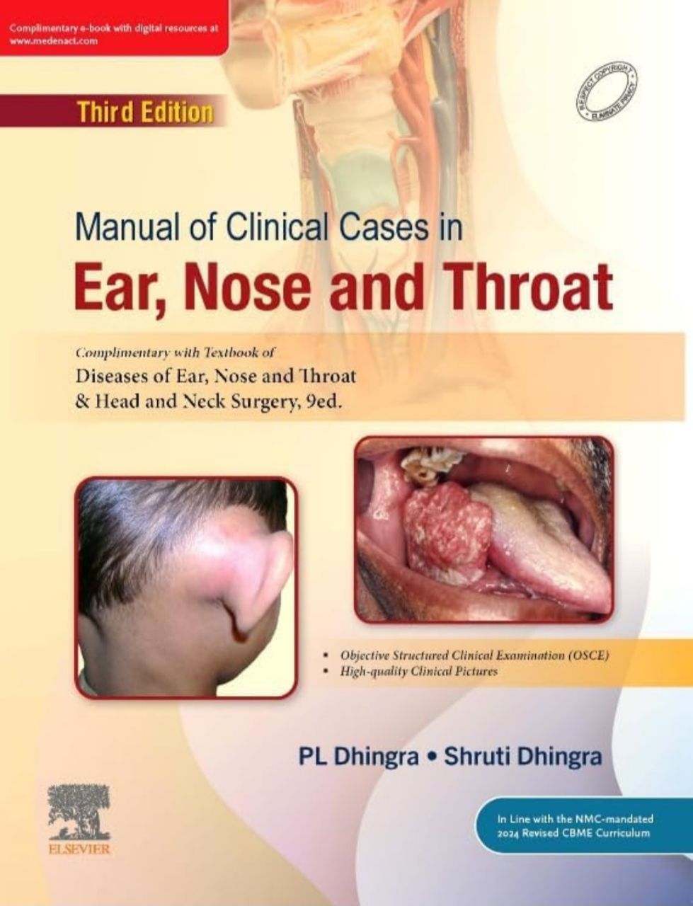 Diseases of Ear, Nose and Throat By Pl Dhingra 9 ED. view 3