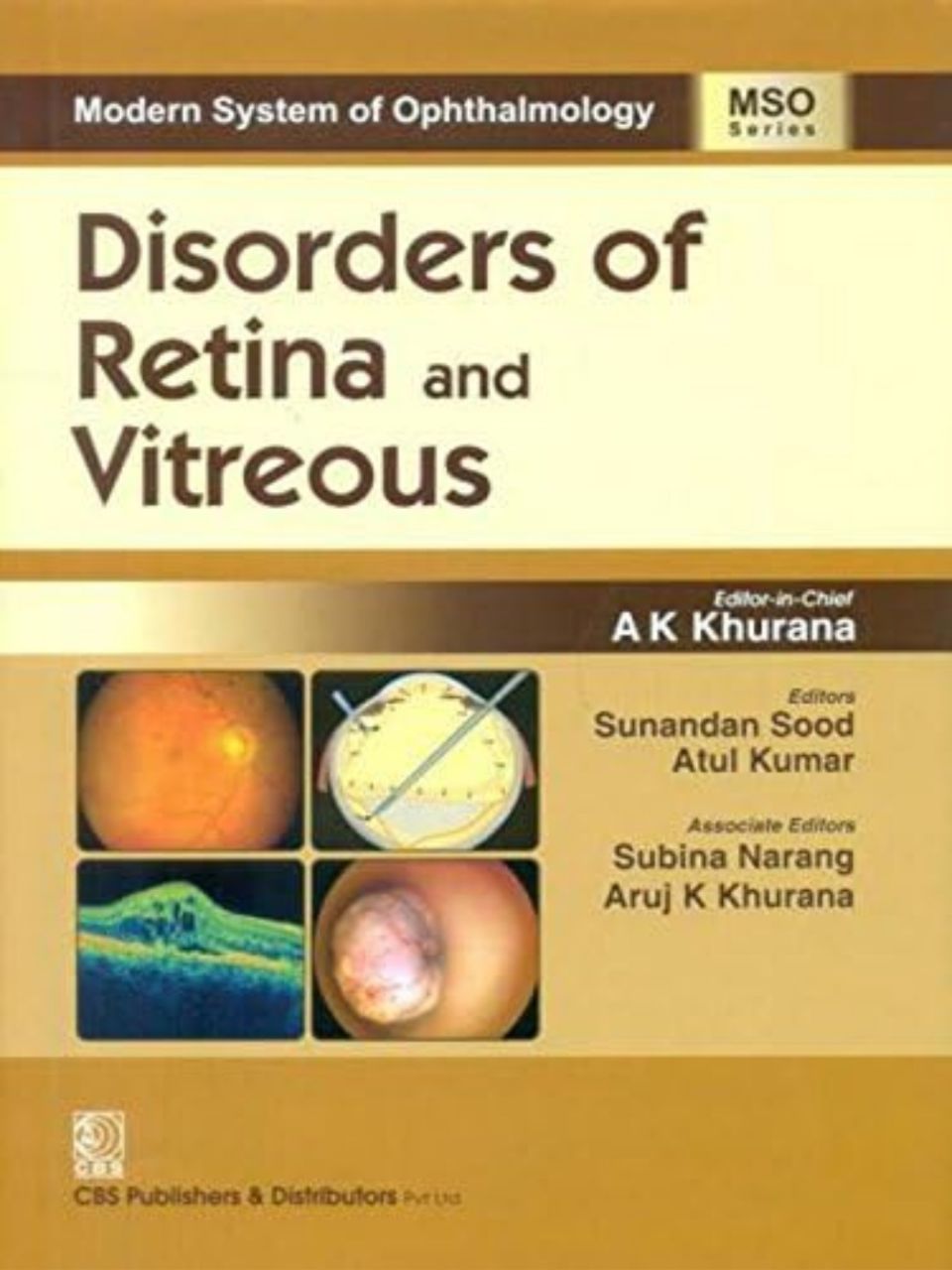 Disorders of Retina and Vitreous By A K Khurana