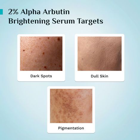 Pilgrim
2% Alpha Arbutin Brightening Serum with 3% Vitamin C | For All Skin Types|Discover Bright And Radiant Skin| Reduces Hyper Pigmentation| Brightens Skin Anti - Aging | For Men & Women view 6